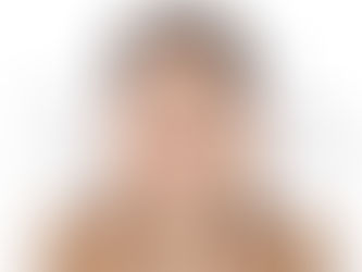 L’idratazione after Sun!