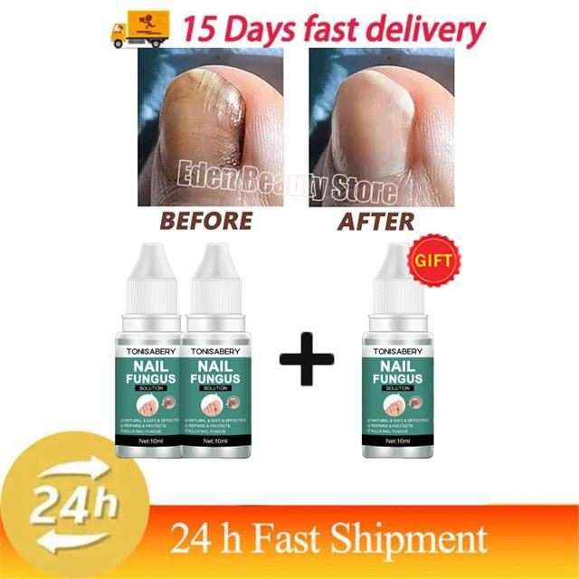 Thumbnail: Nail Fungus Treatment Serum Foot Repair Liquid Toe Nails Fungal Removal Gel Anti