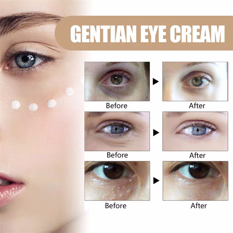 Thumbnail: Fat Granules Removal Eye Serum Anti Dark Circle Eye Bags Fade Fine Line Essence 