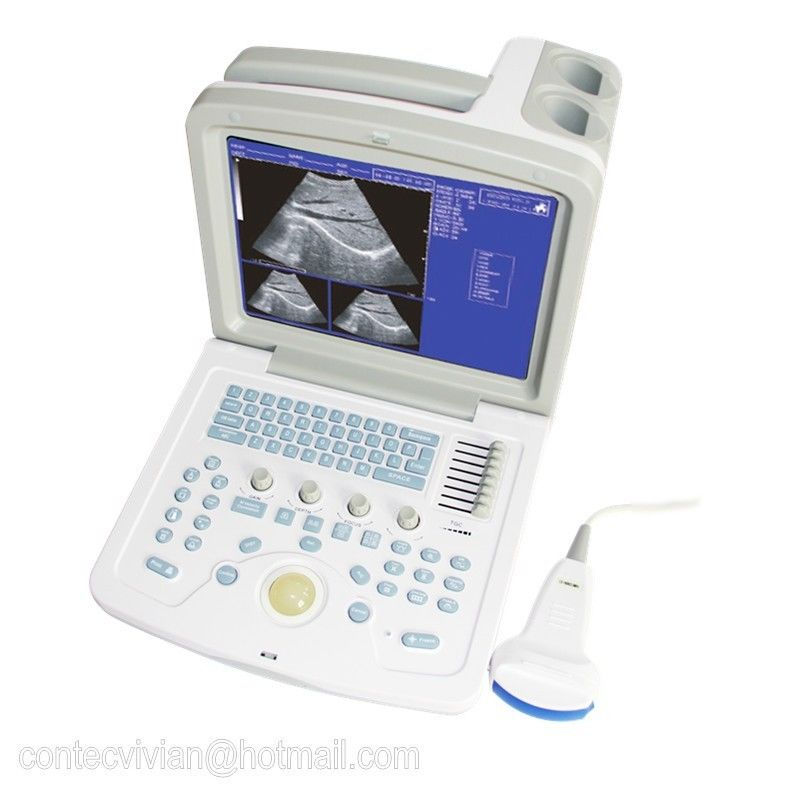 Thumbnail: CE CMS600B-3 Portable Digital Ultrasound Scanner Machine 3.5MHZ Convex Video+USB
