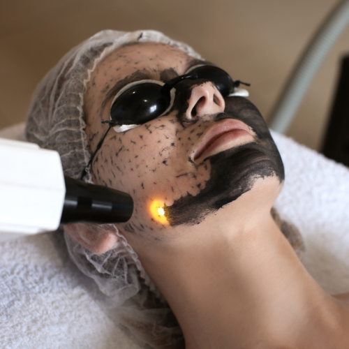 Hollywood-Carbon-Facial.png