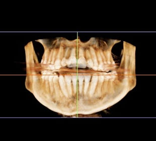 3d scan for website (1)_edited.jpg