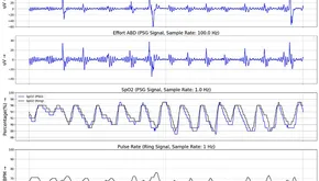 ring-worn pulse oximeter