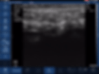Cheek & Forehead, B mode, Linear probe