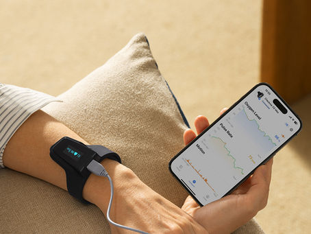 How PPG Technology Reforms Sleep Studies and Aids in Sleep Apnea Diagnosis