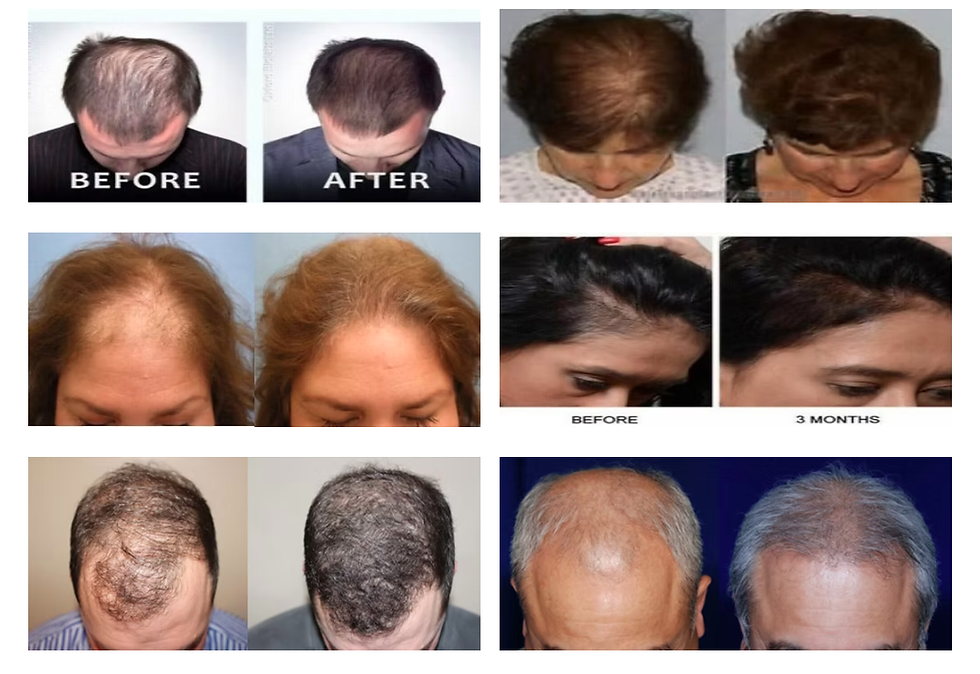 PRP hair treatment cost NJ