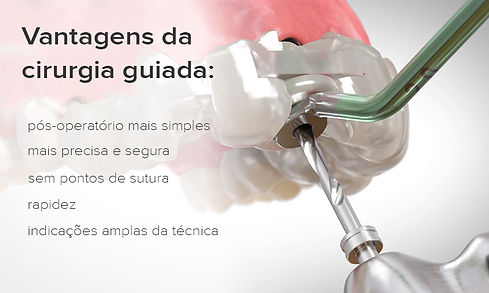 implantes sem cortes