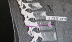 Spine surgical trainer