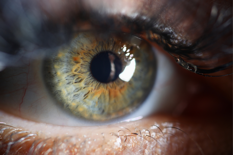 How Can the Iris of the Eye Reflect Conditions in Our Body?