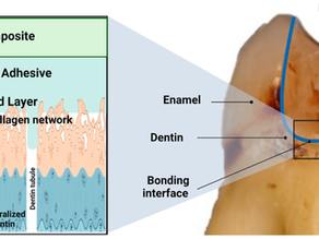 Etching, Self-Etching, and Adhesives: Making Sense of Modern Bonding Protocols
