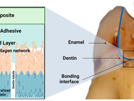 Etching, Self-Etching, and Adhesives: Making Sense of Modern Bonding Protocols