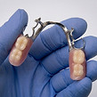 protesis dental removible metalica