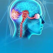 Neurorehabilitation care, Chennai