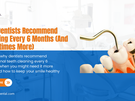 Why Dentists Recommend Cleaning Every 6 Months (And Sometimes More)