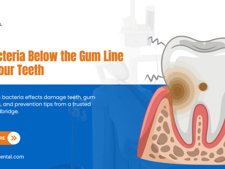 How Bacteria Below the Gum Line Affect Your Teeth