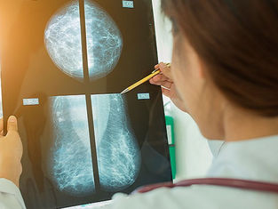 Secretaria de Saúde intensifica ações para mulher no outubro rosa