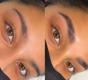 Brow lift at home.jpeg