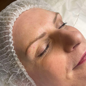Microblading Before & After