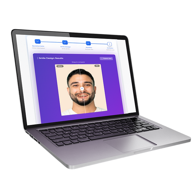 mock up mac book_predismile-EN_NB.png