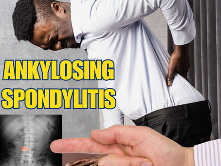 How to Manage Ankylosing Spondylitis Pain with Effective Exercises – Your Guide to a Healthier, Stronger Body