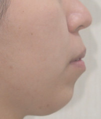 1120111 側面照.JPG