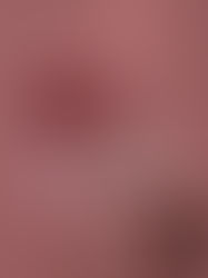 Coceira na região íntima 