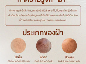 มาทำความรู้จักกับฝ้ากัน ฝ้าคืออะไร?