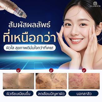 SYLFIRM X PLUS-03.jpg