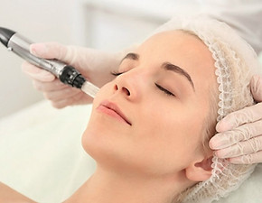 Microneedling-1200x900-1_edited.jpg