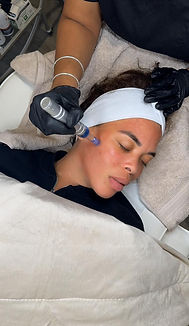 Hertford Cosmetics | Microneedling