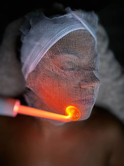 Chemical Peel in Enfield | Hertford Cosmetics