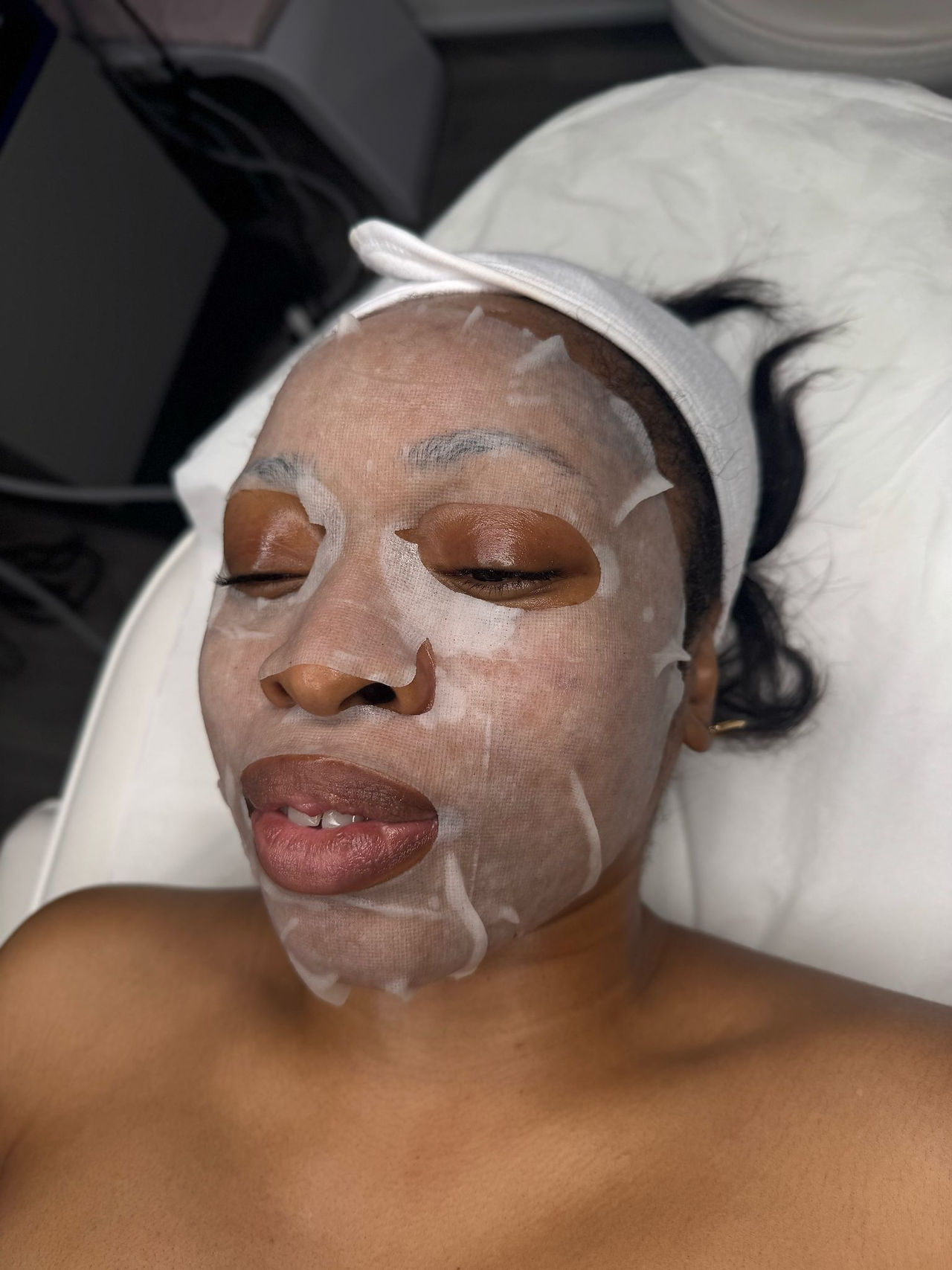 Rosacea treatment client mask