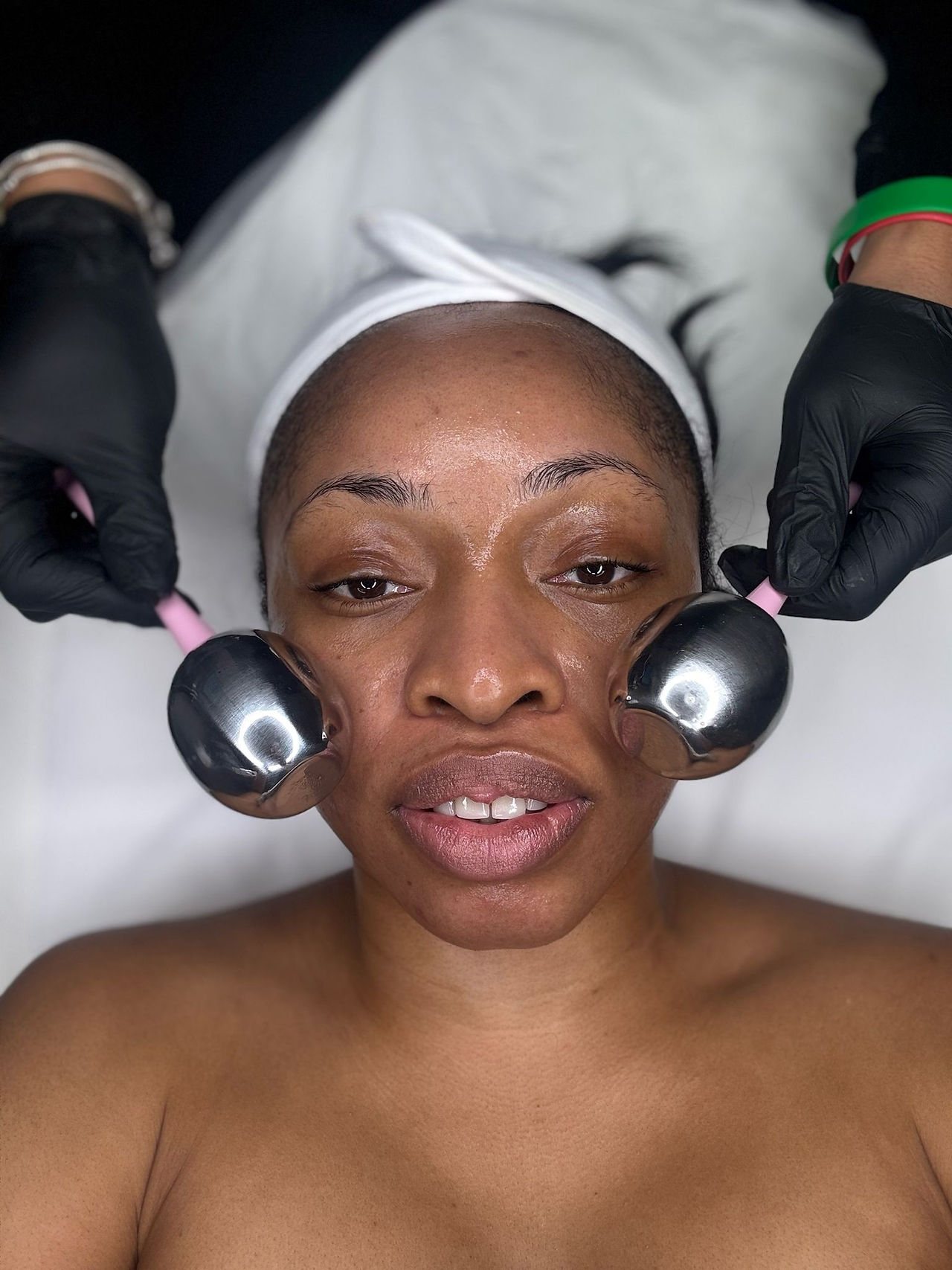 Rosacea treatment client front