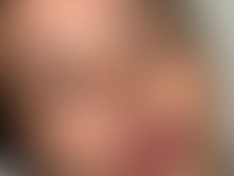 What are B12 shots? Discover the benefits of Vitamin B12 injections