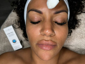 Chemical Peel vs. Microdermabrasion