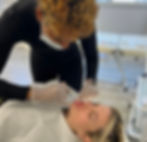 Botox Lip Flip at Hertford Cosmetics