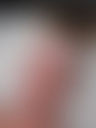 Top 5 Aesthetics Treatments in Hertford