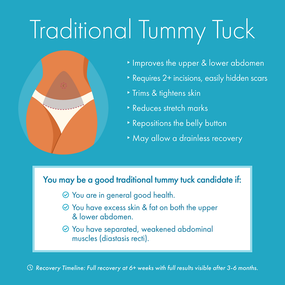 Which Tummy Tuck is Right for You? III