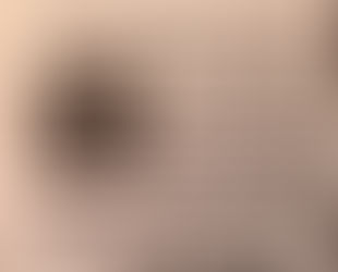 કેમ જરૂરી છે આરોગ્ય જાગૃતિ?