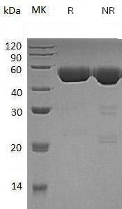 Recombinant Human Cathepsin D/CTSD (C-6His)