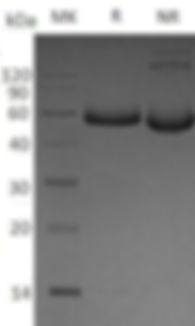 Recombinant Human Fetuin-B/FETUB (C-6His)