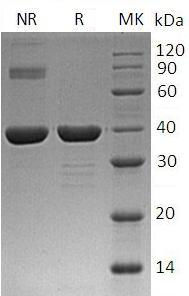 Recombinant Human Carbonic Anhydrase 8/CA8 (C-6His)