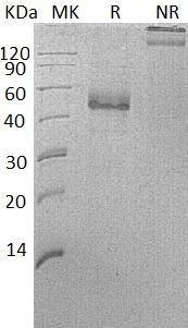 Recombinant Human ICOS/CRP-1/AILIM/CD278 (C-Fc)