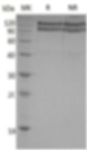 Recombinant Human Brain-Specific Angiogenesis Inhibitor 3/BAI3 (C-6His)