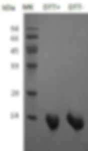 Recombinant Human Parvalbumin α/PVALB (C-6His)