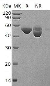 Recombinant Human B3GNT1 (C-6His)