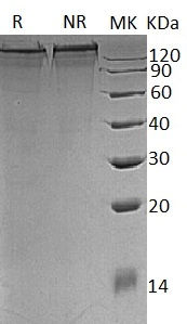 Recombinant Mouse Collagen α-1(III) Chain/COL3A1 (C-6His)