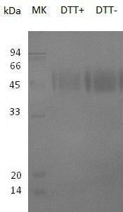 Recombinant Human Signaling Lymphocytic Activation Molecule/SLAM/CD150 (C-6His)