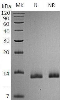 Recombinant Human Pro-Neuropeptide Y/NPY (C-6His)