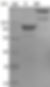 Recombinant Human Signal-Regulatory Protein α-1/SIRPA/CD172a (C-Fc)